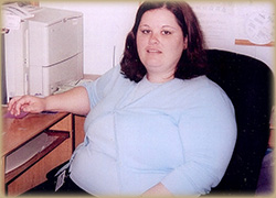 Before Dr. Taunk Weight Loss Program Photo of Patient Before Weight Loss Program
